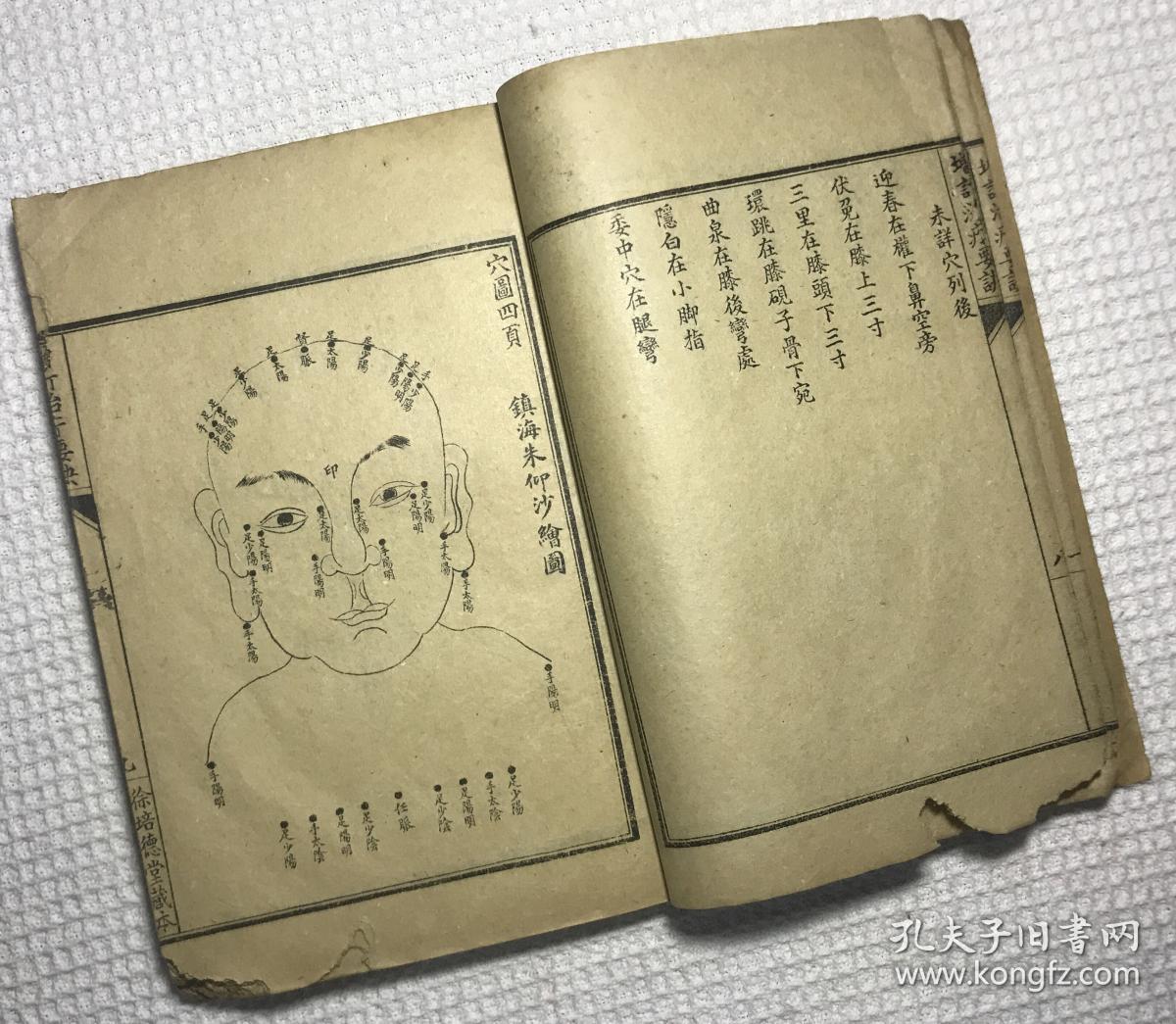 增订治疔要诀烂喉丹痧辑要合刊