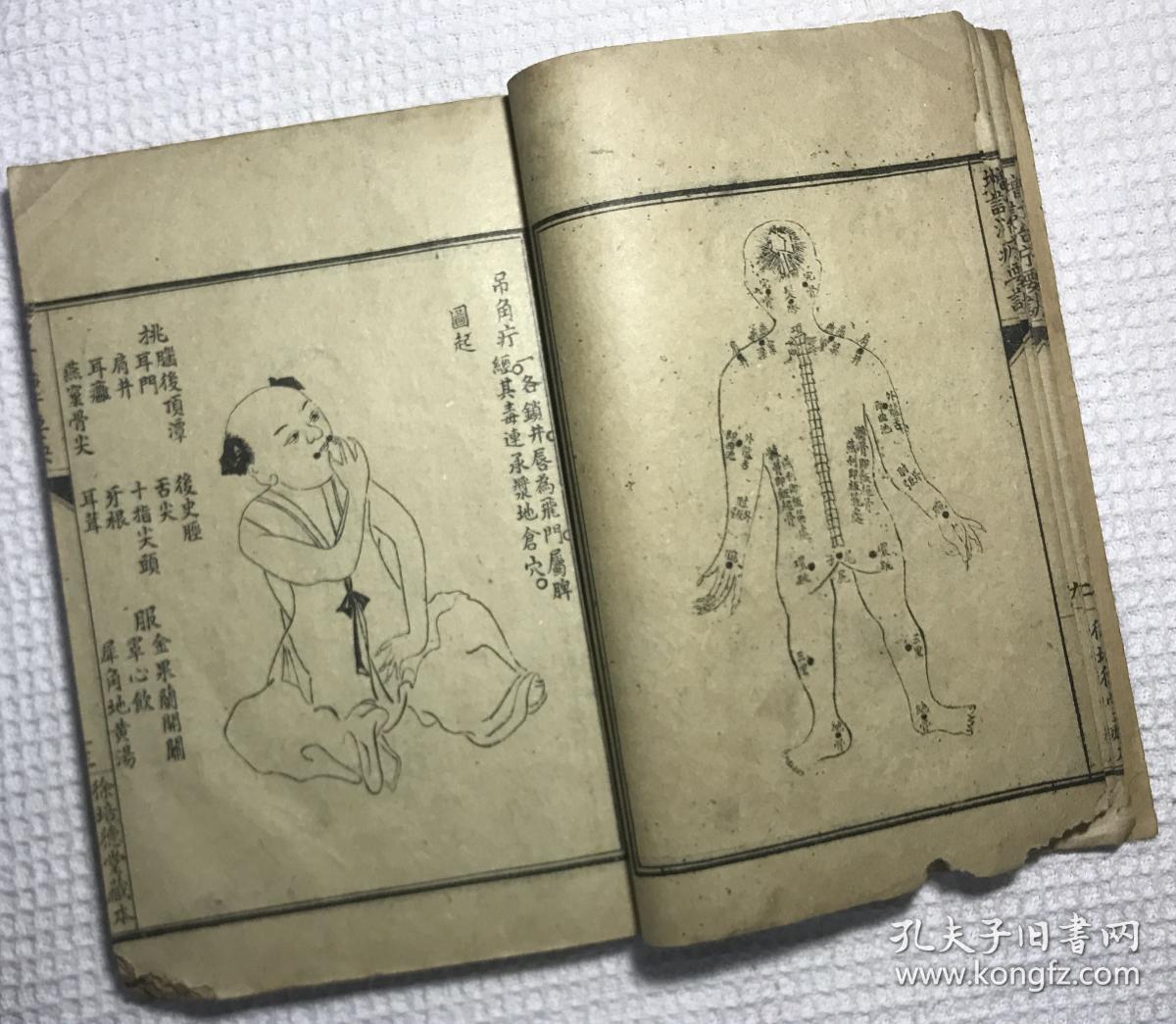 增订治疔要诀烂喉丹痧辑要合刊