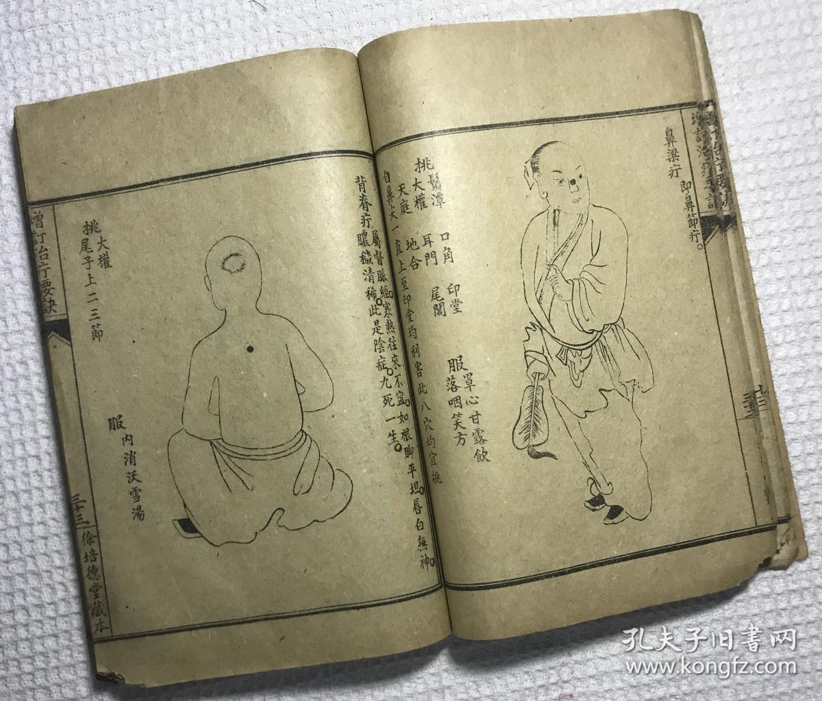 增订治疔要诀烂喉丹痧辑要合刊