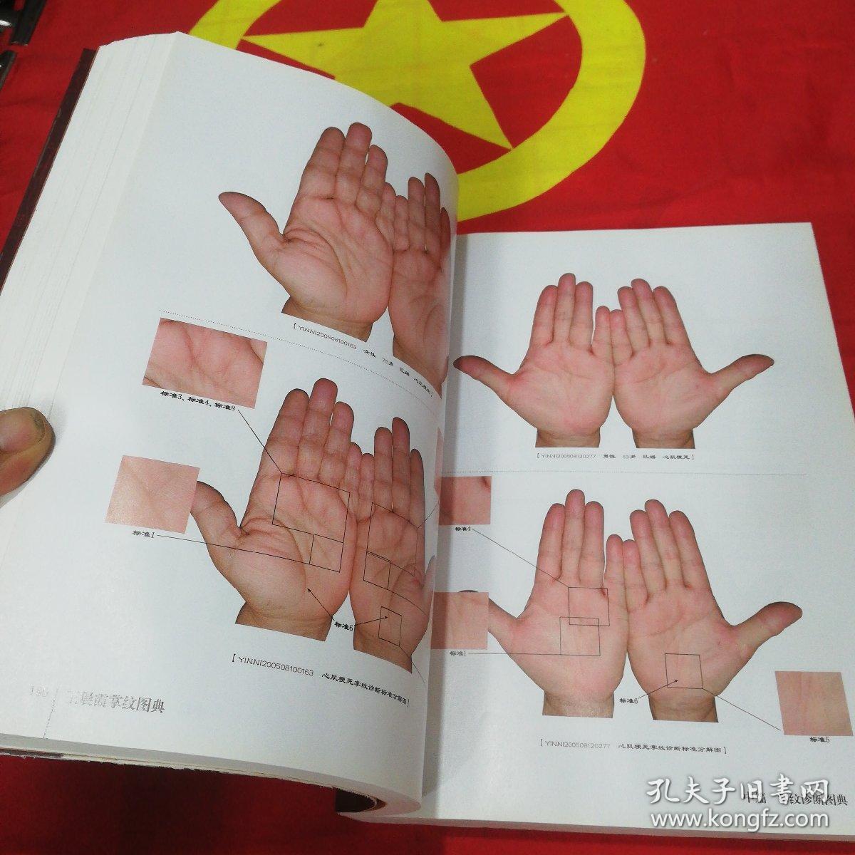 王晨霞掌纹图典