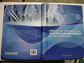 Non-Surgical Treatments for Avascular Necrosis o
