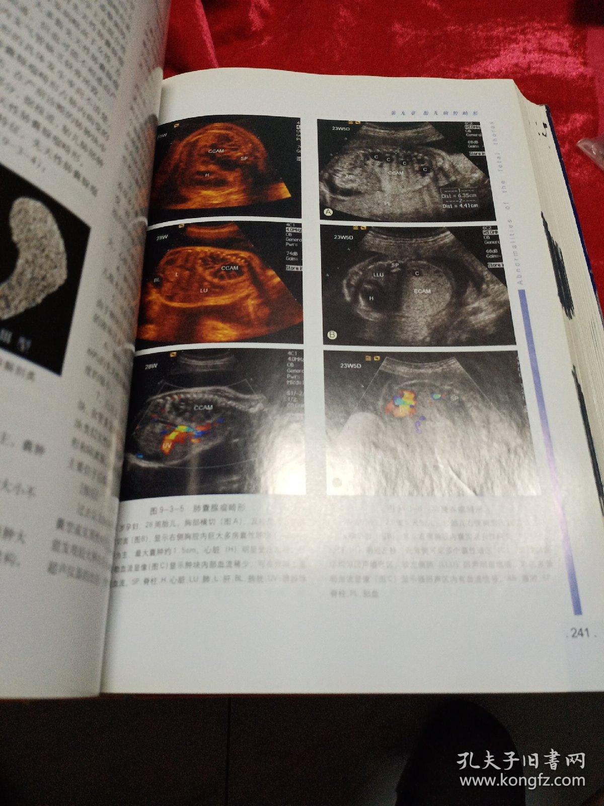 胎儿畸形产前超声诊断学