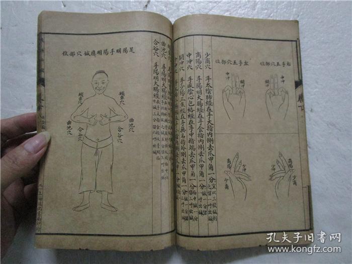 民国庚申年线装本 《烂喉丹痧辑要 》《详图喉科秘錀》上下卷 合为一