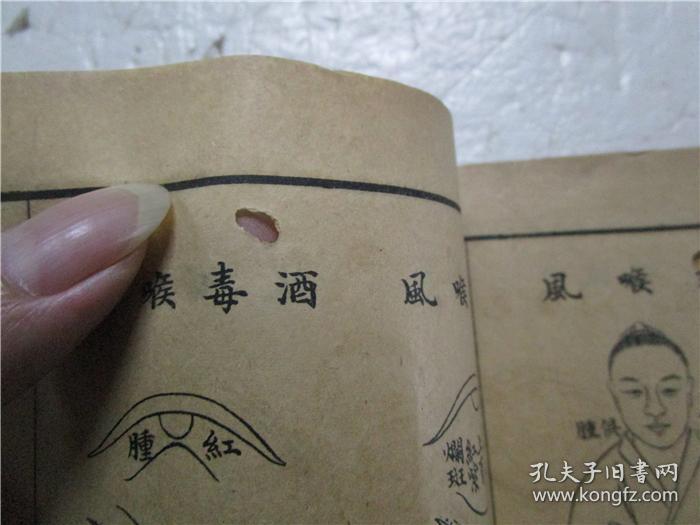 民国庚申年线装本 《烂喉丹痧辑要 》《详图喉科秘錀》上下卷 合为一