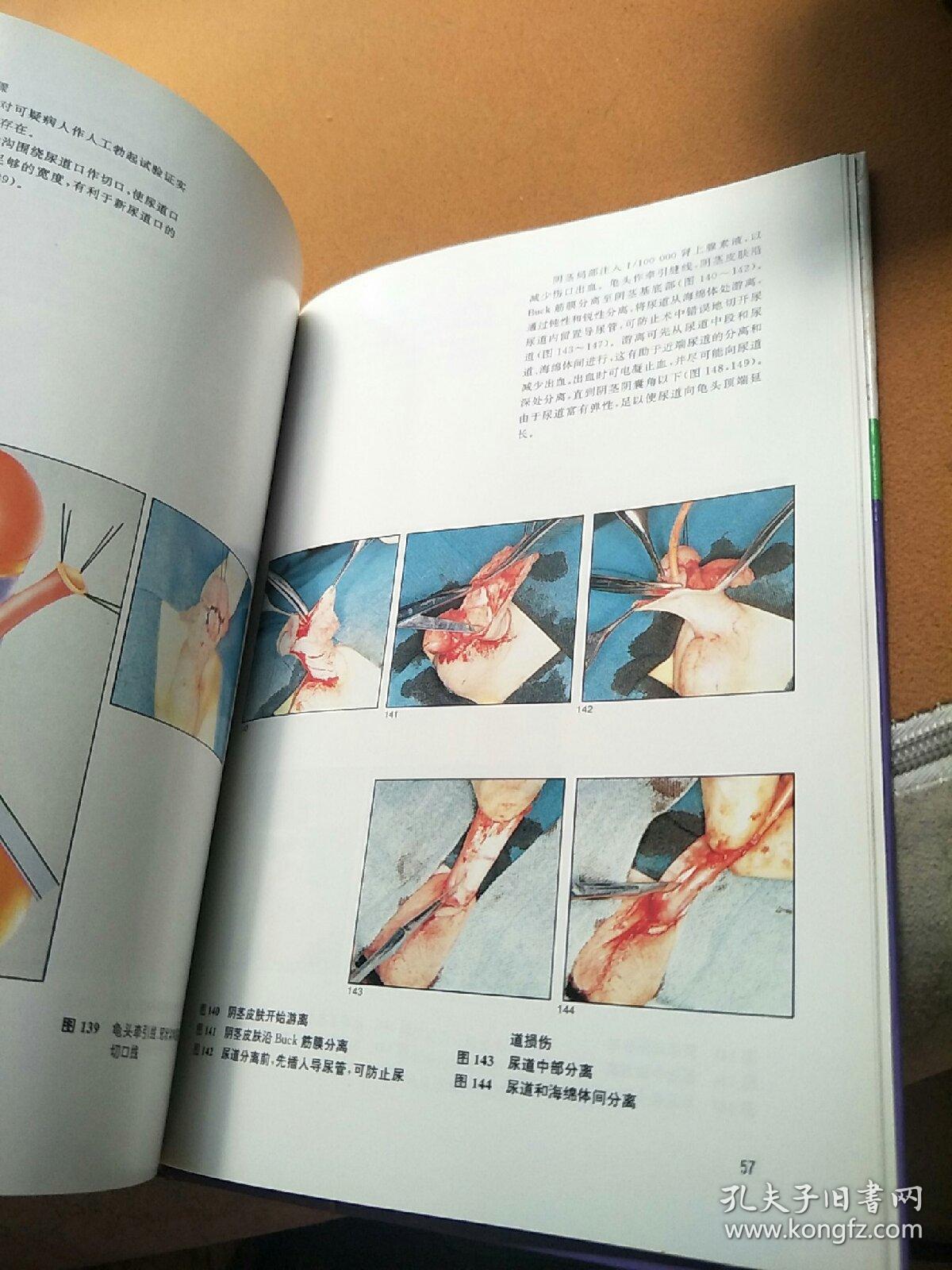 尿道重建手术图谱