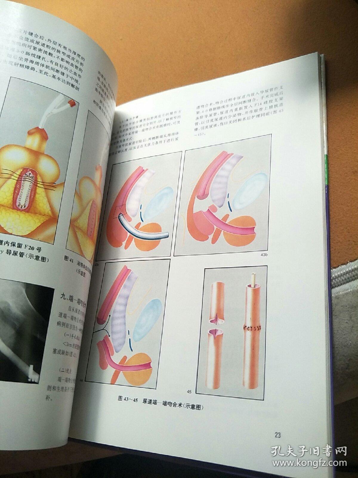 尿道重建手术图谱