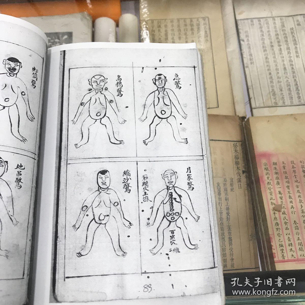 种子良图 影印清代手抄本老中医 多图收录救吞鸦片方 难产神方 缩阴症