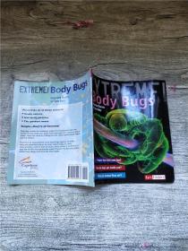 Extreme！Body Bugs [Scholastic]: Uninvited Guests on Your Body.