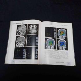 颅脑影像新技术诊断图谱