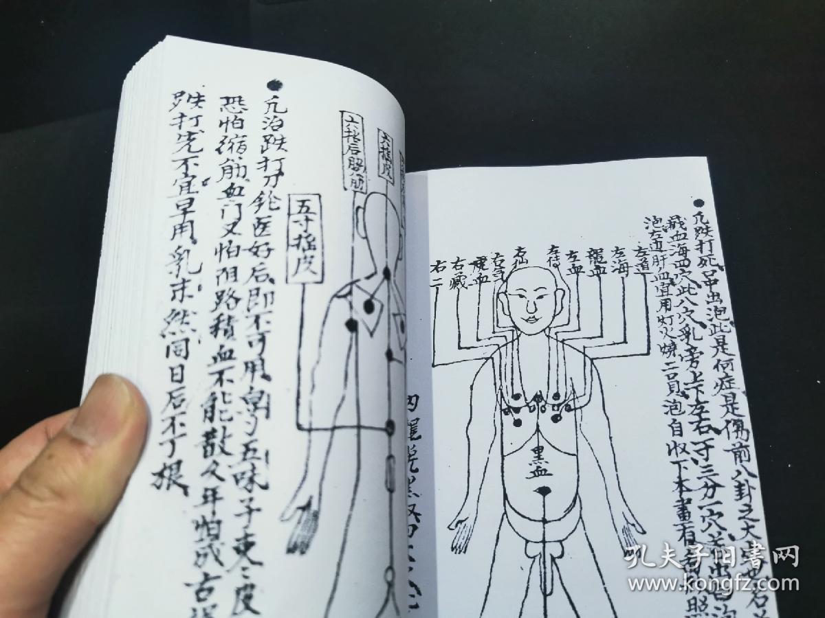打三十六大穴,七十二小穴,急用照书加减秘传,精细骨伤科穴位人物绘图