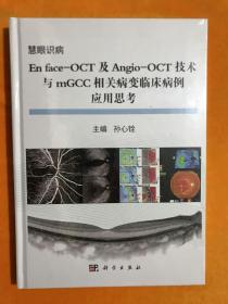 慧眼识病:En face-OCT及Angio-OCT技术与mGCC相关病变临床病例应用思考 【全新未开封】