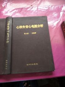 心律失常心电图分析