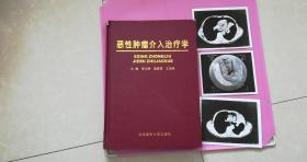 恶性肿瘤介入治疗学（附3张照片）精装一版一印 5000册 书内9品