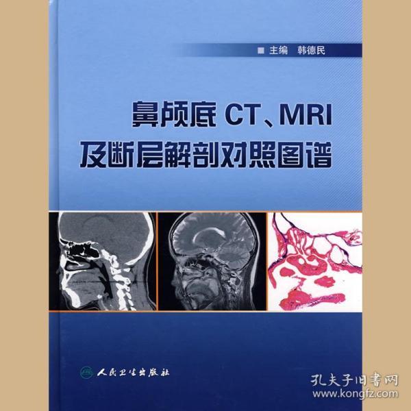 鼻颅底ct,mri及断层解剖对照图谱