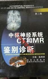 中枢神经系统CT和MR鉴别诊断第二版
