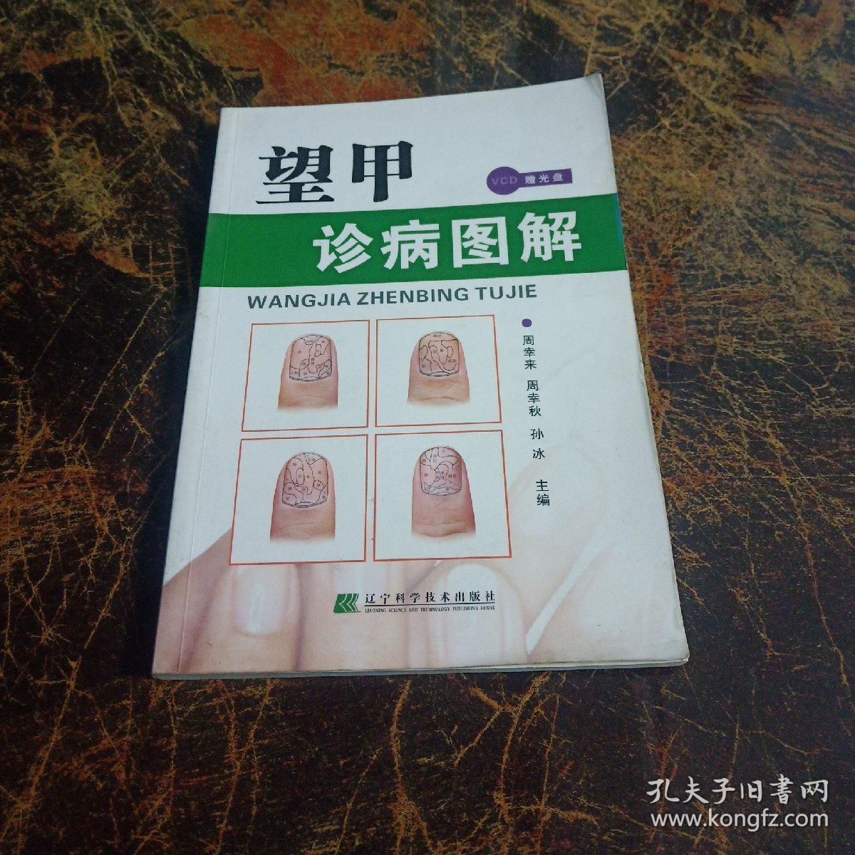望甲诊病图解 无光盘