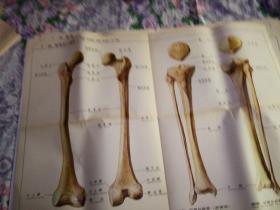 人体解剖挂图  骨及骨连结 Ⅰ—20.股骨及小腿骨