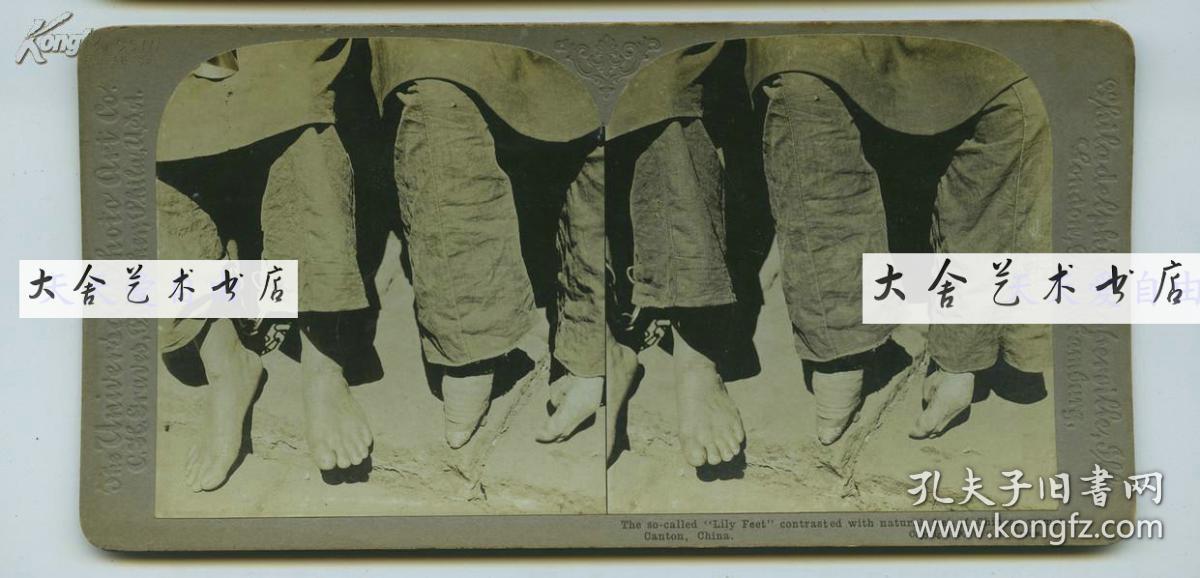 民国妇女小脚缠足三寸金莲特写照片